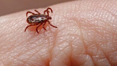 Primeiro caso de febre maculosa autóctone é registrado em Sorocaba