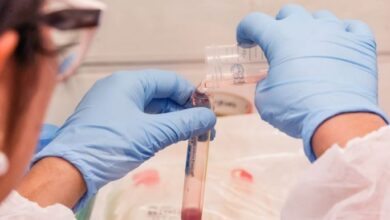 Casos de COLESTEROL ALTO aumentam mais de 40% no SUS